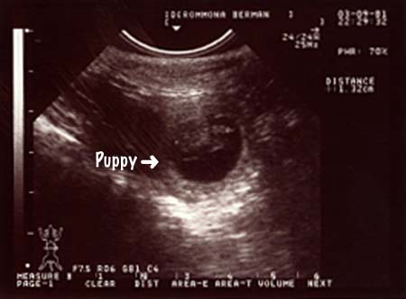 Ultrasound Image